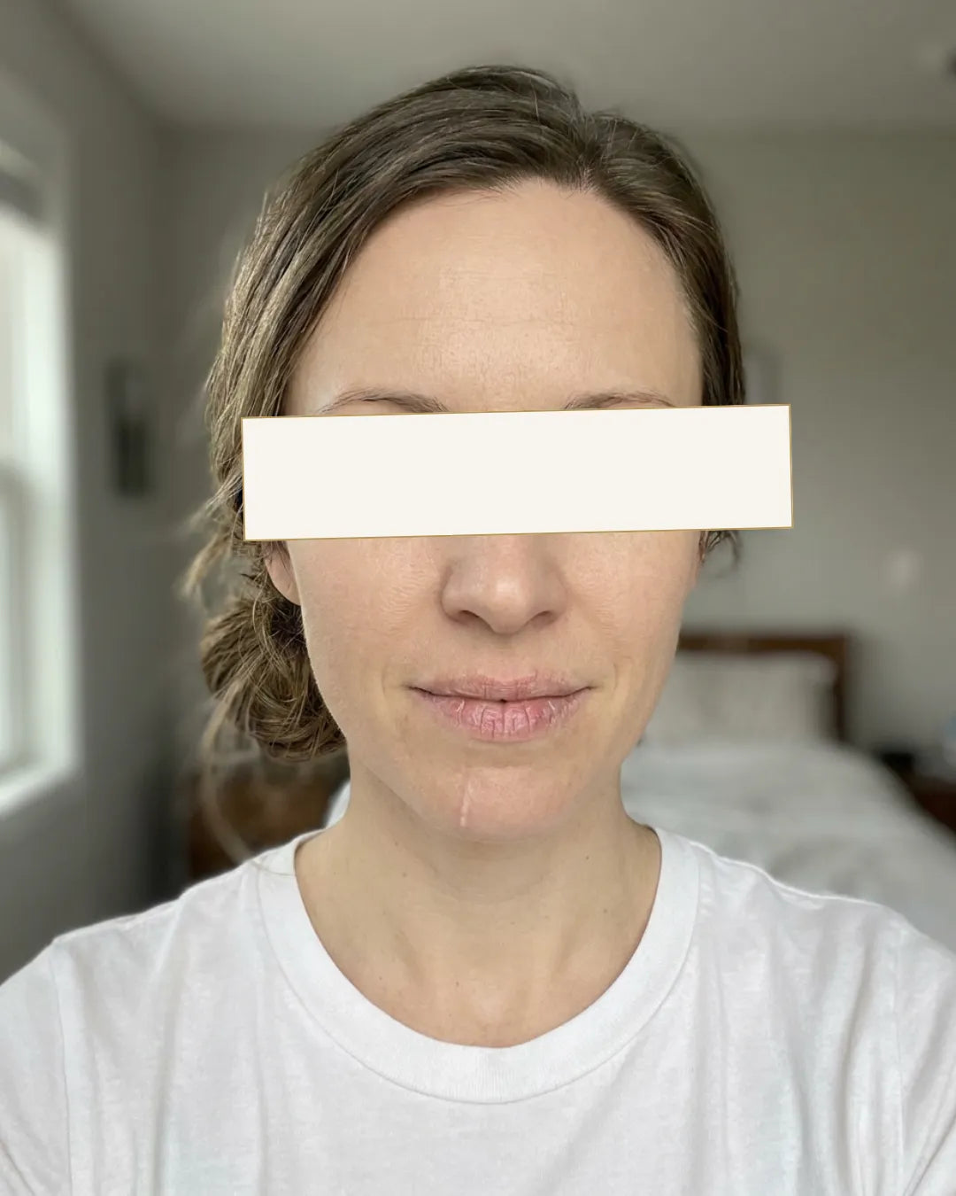 Јасна, 34- Дехидрирана кожа и површински линии — Пред