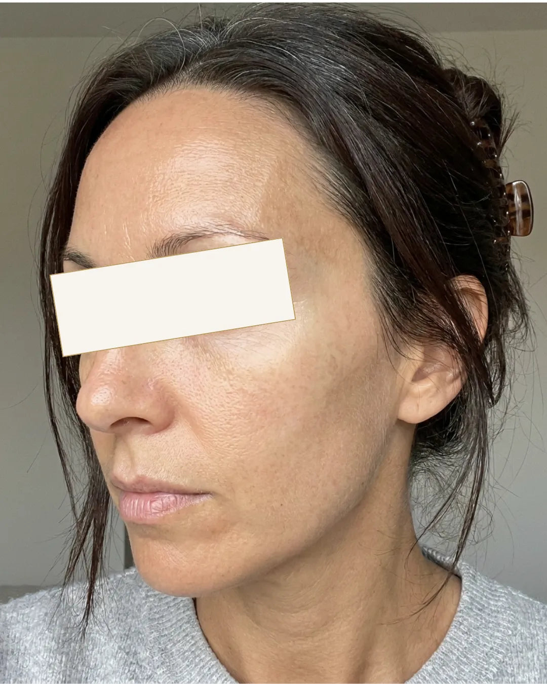 Елира, 34 — Потоа