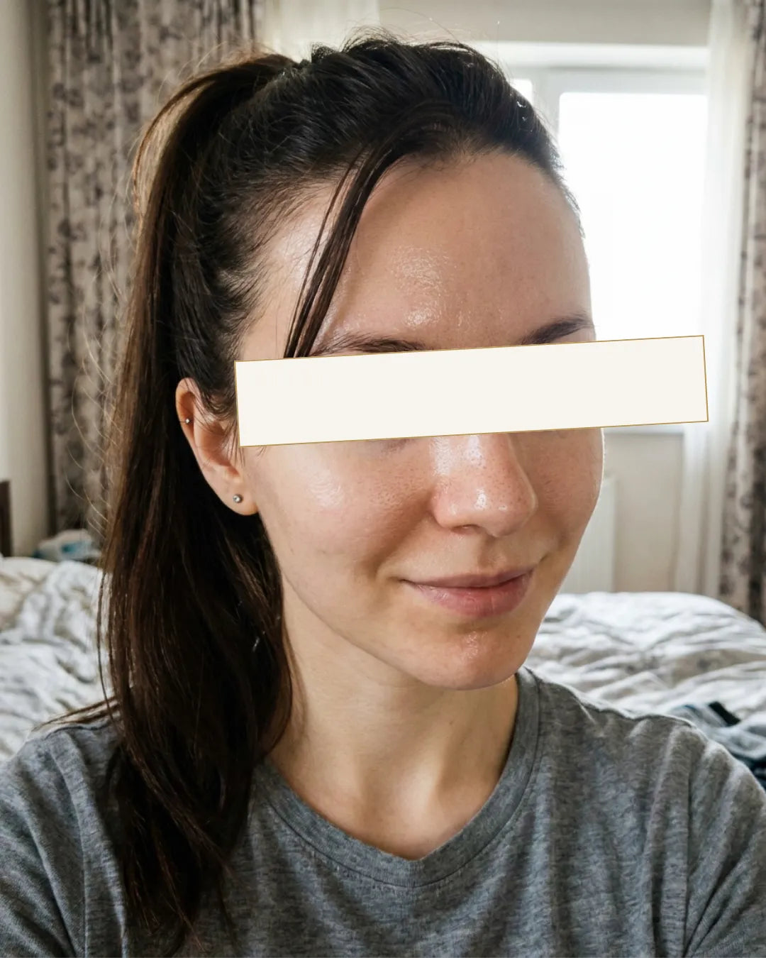 Ивана, 23 - Масна Т-зона & досаден финиш на кожата без сјај — Пред