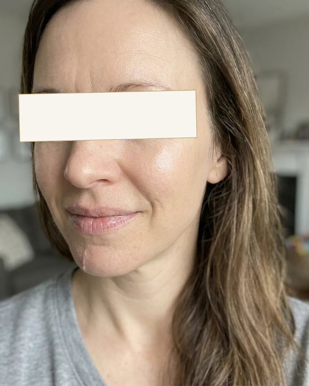 Јасна, 34- Дехидрирана кожа и површински линии — Потоа