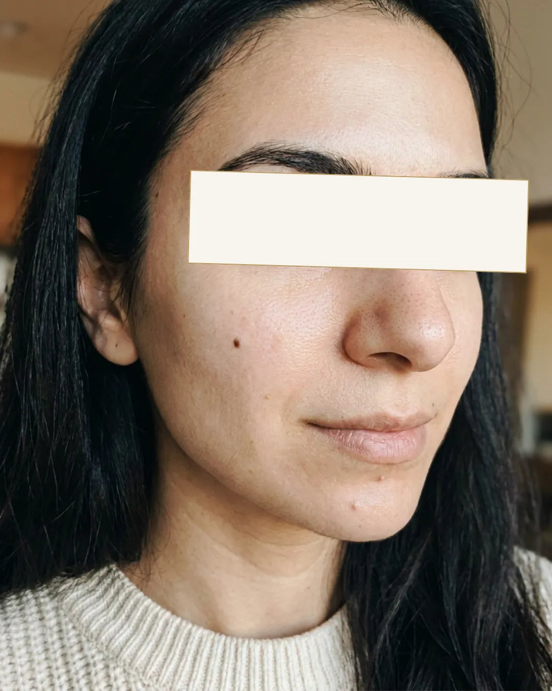 Калина, 27 - Затнати кожа и пори & досаден тен без сјај — Потоа