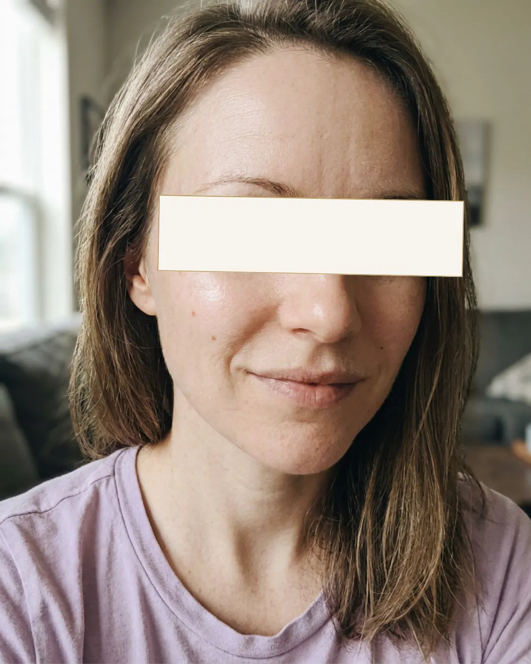 Кристина, 28 - Дехидрирана, досадна кожа — Потоа