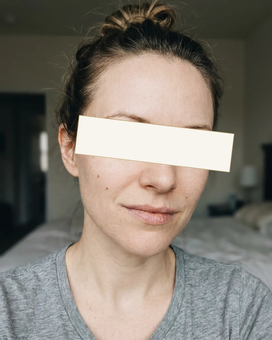 Кристина, 28 - Дехидрирана, досадна кожа — Пред