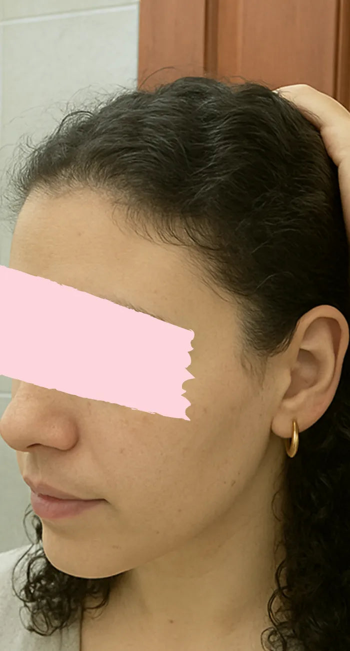 Бесарта, 35 — Потоа